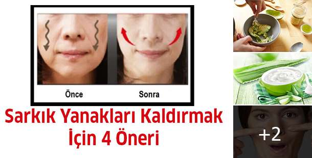 Sarkık Yanaklarla Baş Etmek İçin 4 Öneri