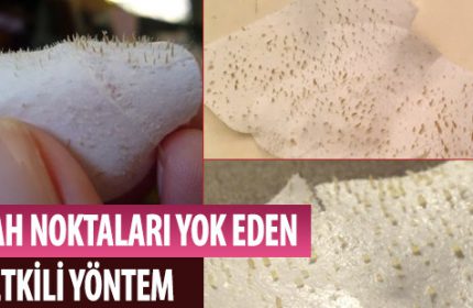 Yumurta Akı Maskesi: Siyah Noktalar İçin En Etkili Yöntem
