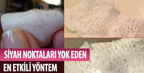 Yumurta Akı Maskesi: Siyah Noktalar İçin En Etkili Yöntem