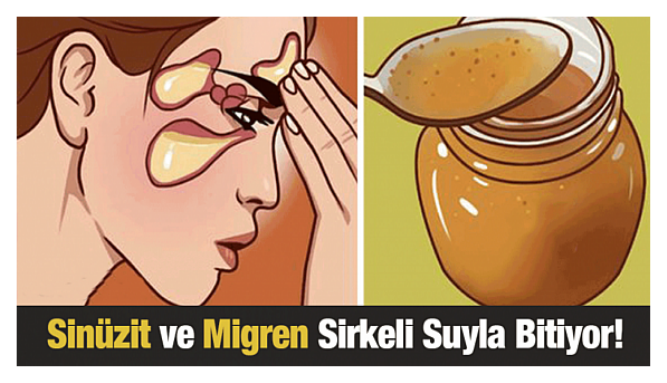 Sinüzit ve Migren Ağrılarına Son