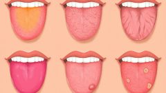 Dilinizdeki Bu Değişiklikler Sağlığınız Hakkında Uyarı Veriyor