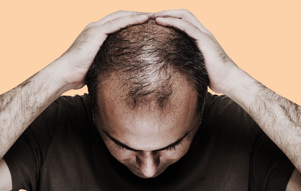 Saç Dökülmesi Tedavisi Dr. Arslan Kliniği’nin Etkili Çözümleri