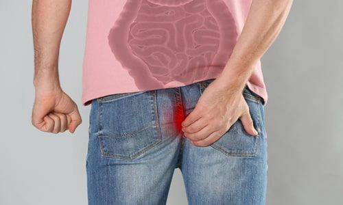 Anal Fistül: Utandıran Değil, Tedavi Edilebilir Bir Hastalık